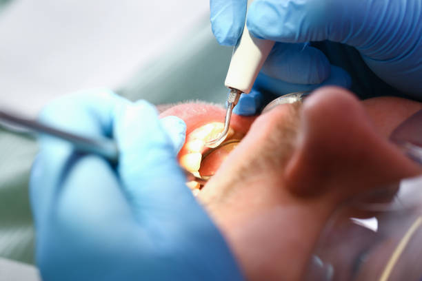 Best Weekend Emergency Dental Services in Middletown, OH