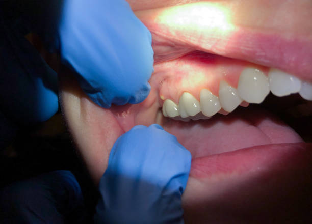 Best Emergency Cosmetic Dentistry (e.g., broken veneers) in Middletown, OH